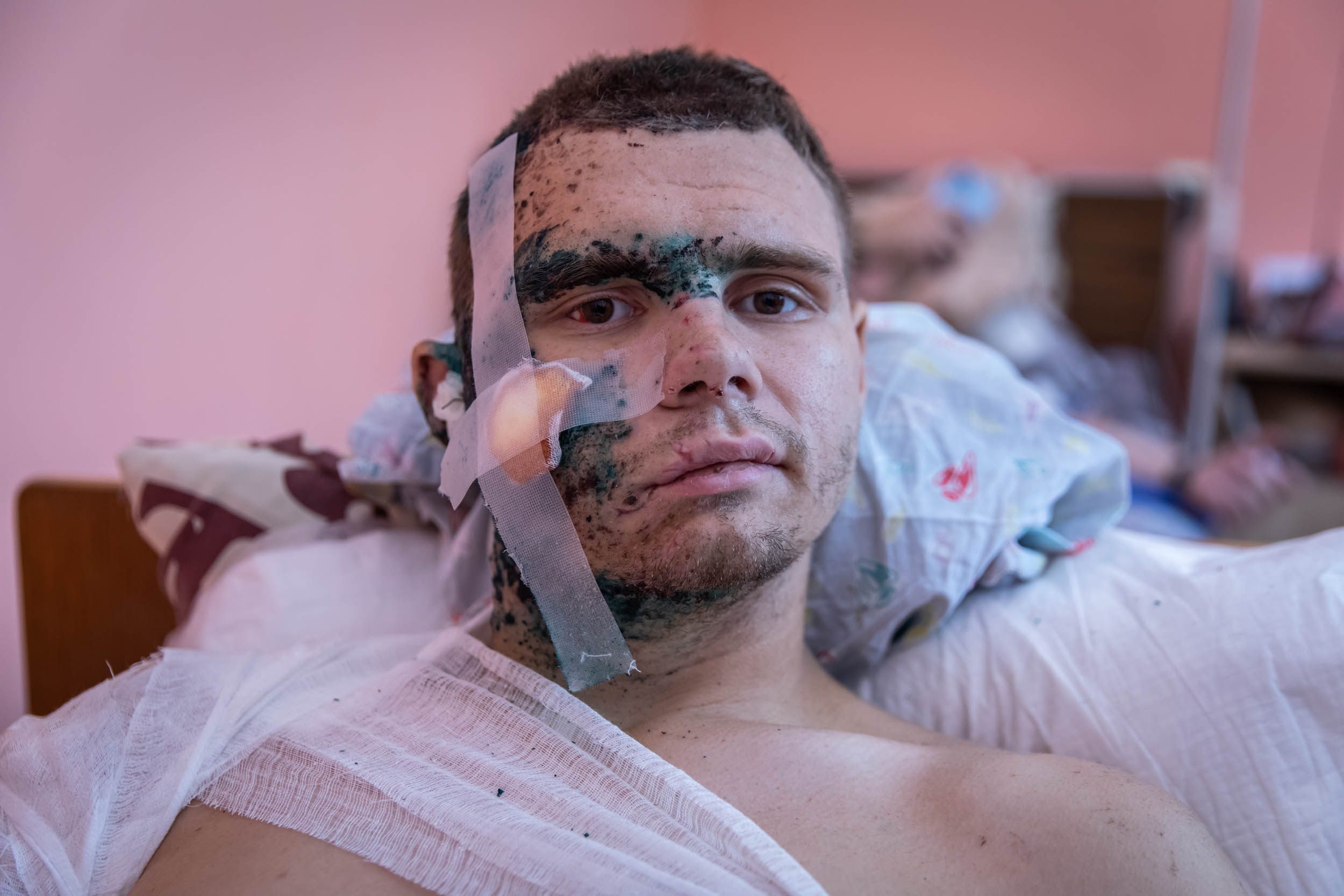 Glyb, injured by a missile while celebrating his graduation at a Black Sea resort.