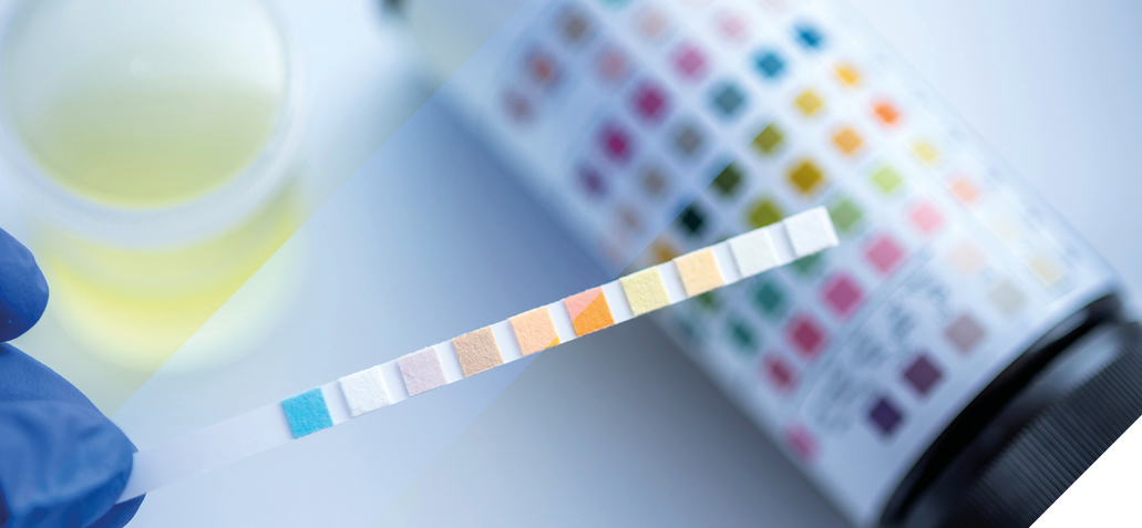 colour chart urinary test strip