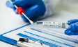 Henri Wallard Le Monde tests PCR