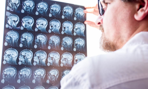 Ipsos | Multiple Sclerosis | Healthcare | White Paper