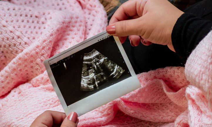 photo sonogram ultrasound pregnancy