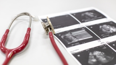 Females' Access to Health Services | Ipsos