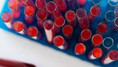 Stammzellspende Slider