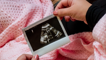 photo sonogram ultrasound pregnancy