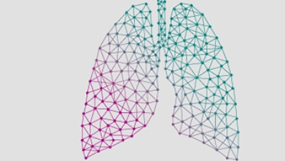 PneuVUE®: A new view into Pneumonia among older adults