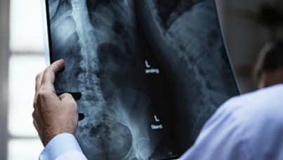 Radiology pulse survey | Ipsos | Healthcare