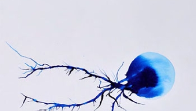 What matters to the public in neuroscience and mental health research? | Ipsos